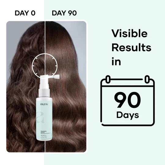 Mars Hair Loss Treatment Combo: Clinically Proven Serum, Biotin & Derma Roller 5 Mars Hair Loss Treatment Combo: Clinically Proven Serum, Biotin & Derma Roller