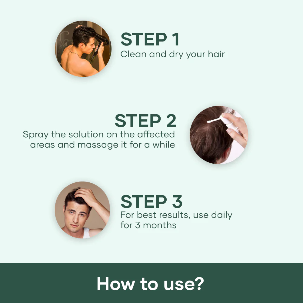 Minoxidil 5% Topical Solution for Men 4 Minoxidil 5% Topical Solution for Men